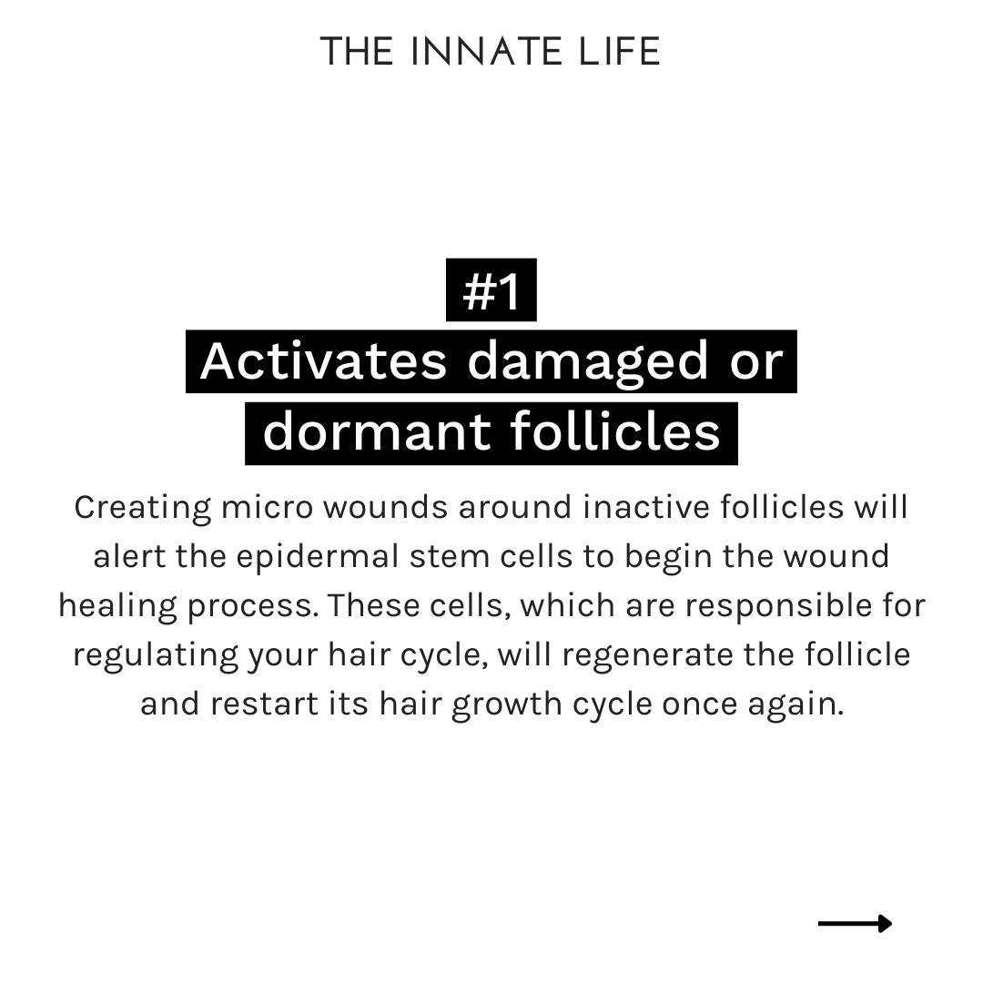 DERMA ROLLER