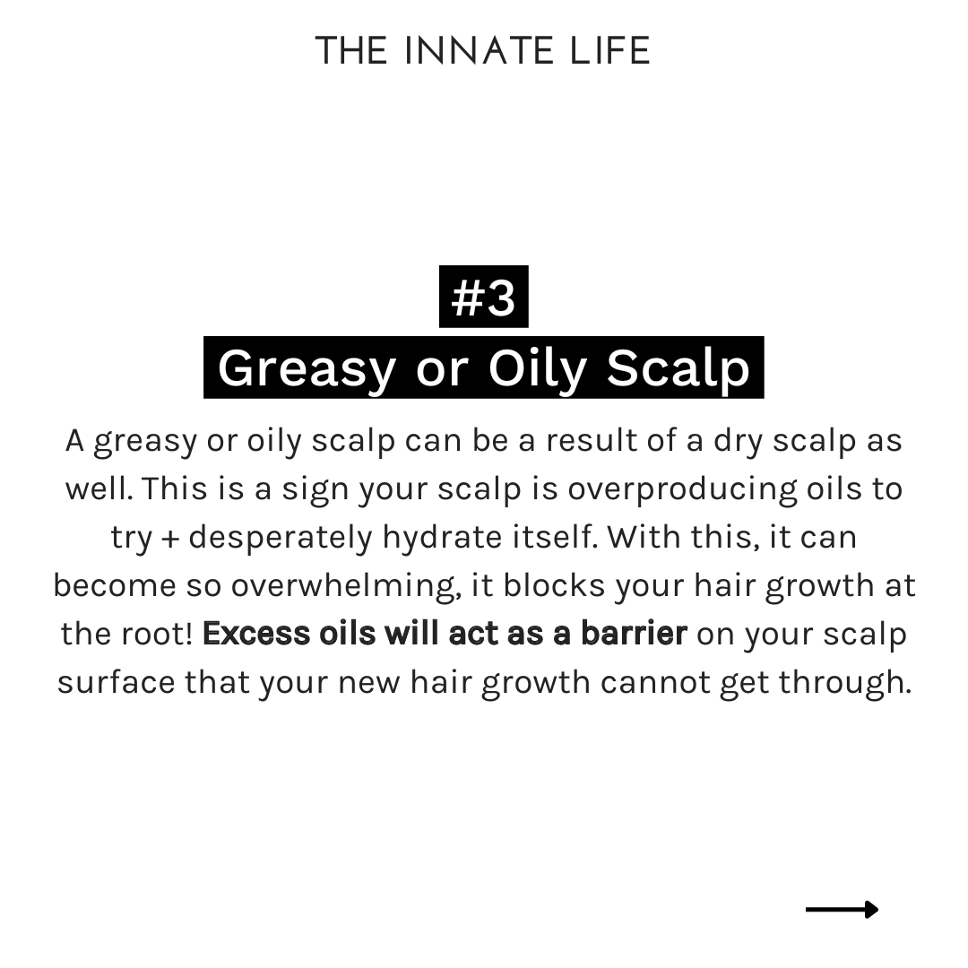 CHARCOAL SCALP DETOX